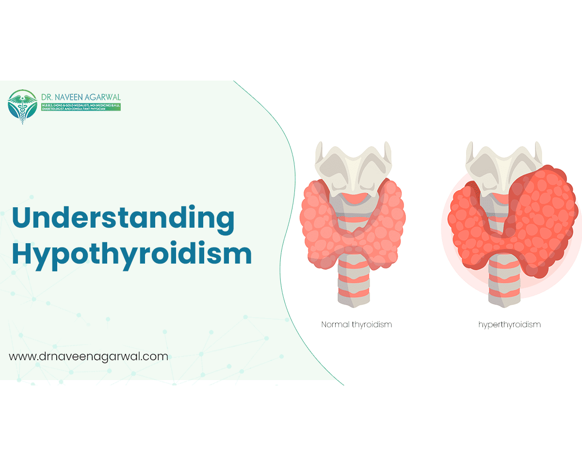 Understanding Hypothyroidism